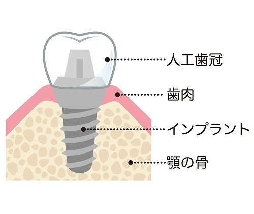 診断と治療計画の提示をいたします