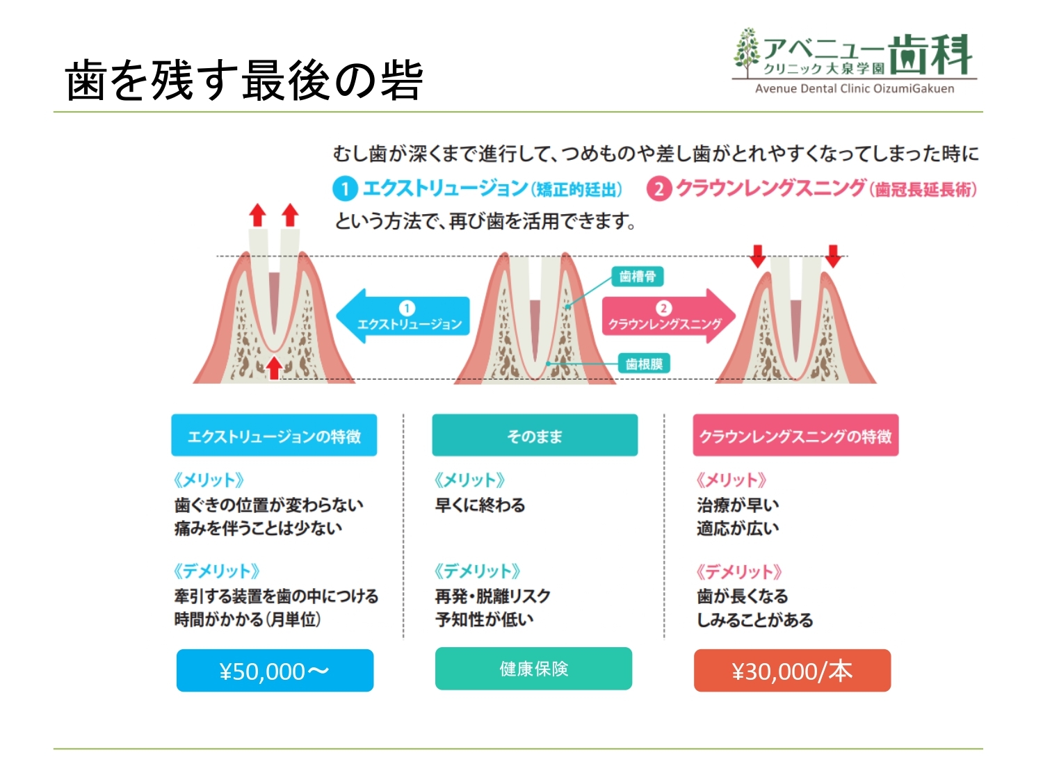 歯周組織再生療法