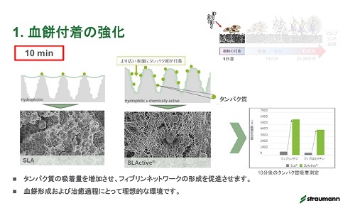 歯を補う方法