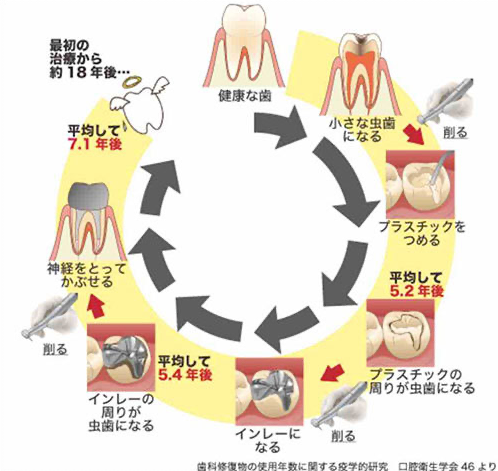 リピートトリートメントサイクル