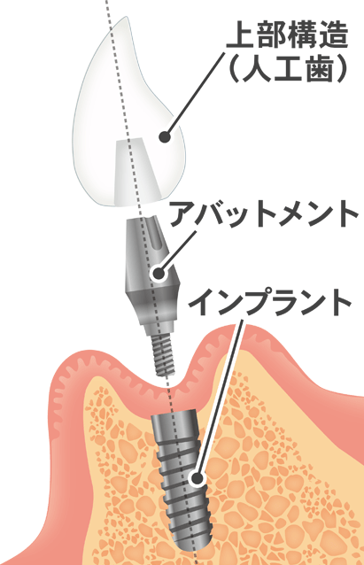 診断と治療計画の提示をいたします